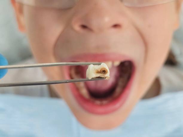 Best Pediatric Emergency Dentist in Elverta, CA